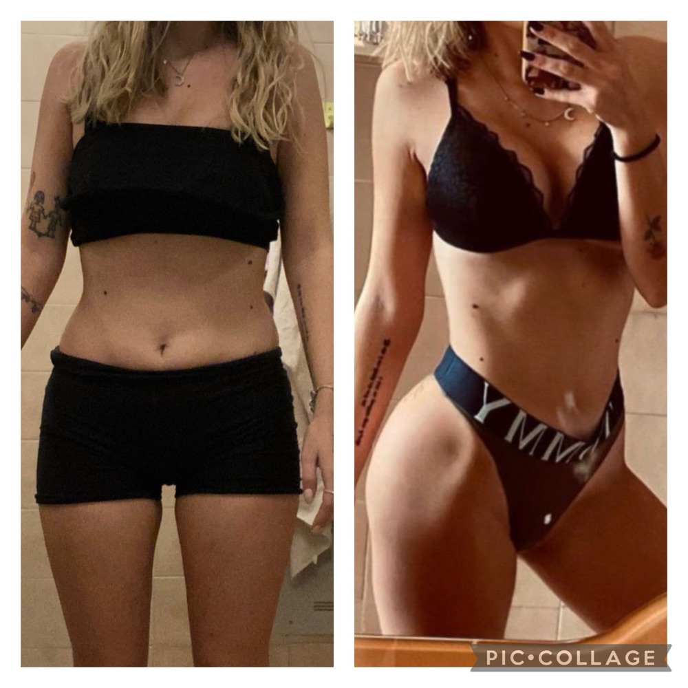 Foto prima e dopo di una cliente